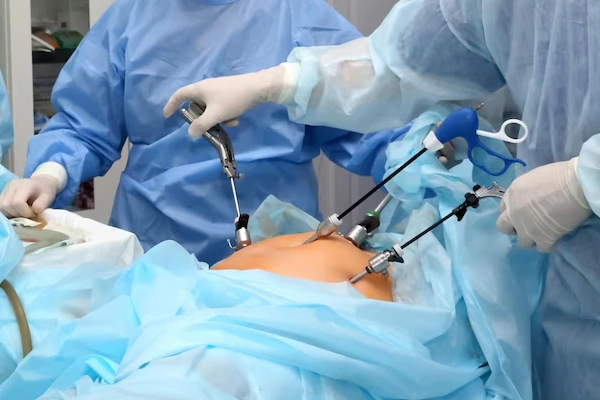 Laparoscopic Procedures